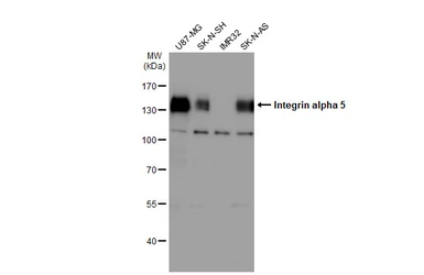 Anti-Integrin alpha 5 antibody used in Western Blot (WB). GTX130705