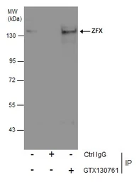 Anti-ZFX antibody used in Immunoprecipitation (IP). GTX130761