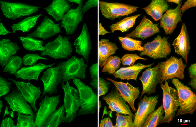 Anti-Plectin antibody used in Immunocytochemistry/ Immunofluorescence (ICC/IF). GTX130764