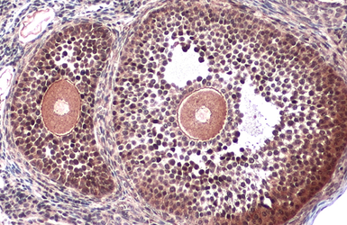 Anti-VRK2 antibody used in IHC (Paraffin sections) (IHC-P). GTX130826