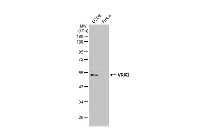 Anti-VRK2 antibody used in Western Blot (WB). GTX130826