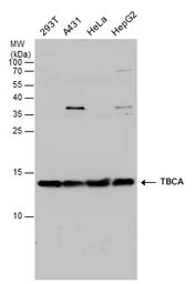 Anti-TBCA antibody used in Western Blot (WB). GTX130832