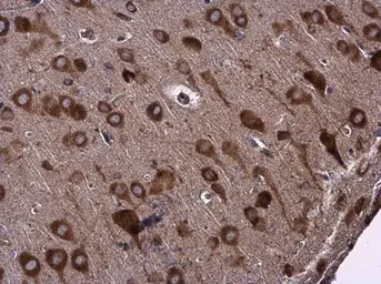 Anti-EPRS antibody used in IHC (Paraffin sections) (IHC-P). GTX130848