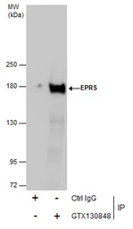 Anti-EPRS antibody used in Immunoprecipitation (IP). GTX130848