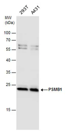 Anti-PSMB1 antibody used in Western Blot (WB). GTX130875