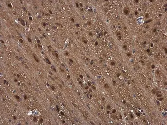 Anti-PSMB1 antibody used in IHC (Paraffin sections) (IHC-P). GTX130875