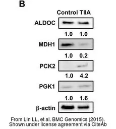 Anti-MDH1 antibody used in Western Blot (WB). GTX130900