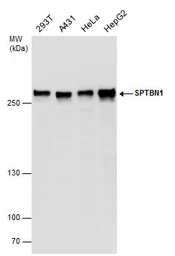Anti-SPTBN1 antibody used in Western Blot (WB). GTX130935