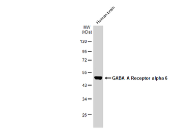 Anti-GABA A Receptor alpha 6 antibody used in Western Blot (WB). GTX130947
