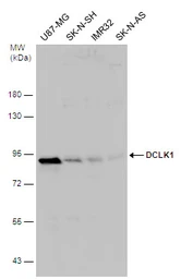 Anti-DCLK1 antibody used in Western Blot (WB). GTX130959