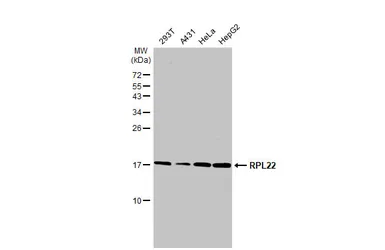 Anti-RPL22 antibody used in Western Blot (WB). GTX130972