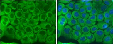 Anti-LRRFIP1 antibody used in Immunocytochemistry/ Immunofluorescence (ICC/IF). GTX131026