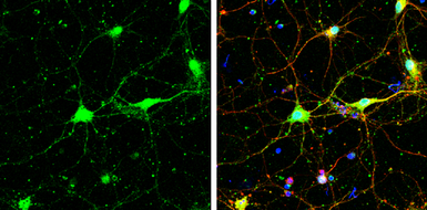 Anti-SNAP29 antibody used in Immunocytochemistry/ Immunofluorescence (ICC/IF). GTX131028