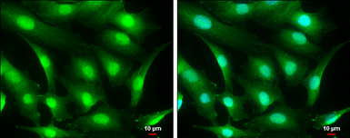 Anti-CRBN antibody used in Immunocytochemistry/ Immunofluorescence (ICC/IF). GTX131077