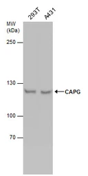 Anti-HCAP-G antibody used in Western Blot (WB). GTX131128