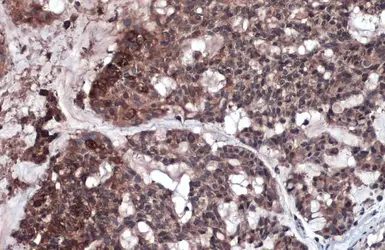 Anti-RIP3 antibody used in IHC (Paraffin sections) (IHC-P). GTX131188