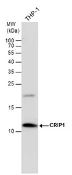 Anti-CRIP1 antibody used in Western Blot (WB). GTX131195