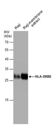 Anti-HLA-DRB5 antibody used in Western Blot (WB). GTX131196