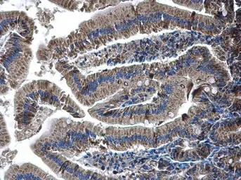 Anti-Glutaminase C (GAC) antibody used in IHC (Paraffin sections) (IHC-P). GTX131263