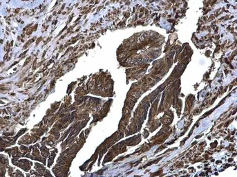 Anti-Glutaminase C (GAC) antibody used in IHC (Paraffin sections) (IHC-P). GTX131263