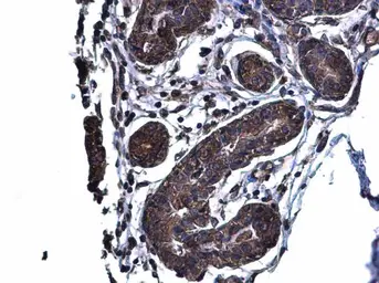 Anti-Glutaminase C (GAC) antibody used in IHC (Paraffin sections) (IHC-P). GTX131263