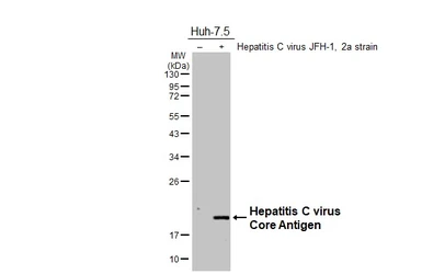 Anti-Hepatitis C virus Core Antigen antibody used in Western Blot (WB). GTX131265