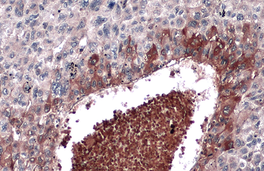 Anti-Alpha fetoprotein / AFP antibody used in IHC (Paraffin sections) (IHC-P). GTX131311