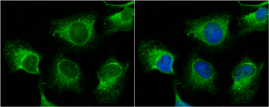 Anti-TNIK antibody used in Immunocytochemistry/ Immunofluorescence (ICC/IF). GTX13141