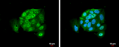 Anti-EIF2C2 antibody used in Immunocytochemistry/ Immunofluorescence (ICC/IF). GTX131422
