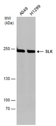 Anti-SLK antibody used in Western Blot (WB). GTX131438