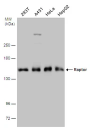Anti-Raptor antibody used in Western Blot (WB). GTX131508