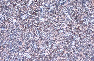 Anti-IL32 antibody used in IHC (Paraffin sections) (IHC-P). GTX131565