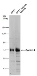 Anti-Cyclin L1 antibody used in Western Blot (WB). GTX131754