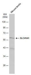 Anti-SLC41A1 antibody used in Western Blot (WB). GTX131796