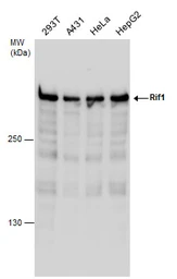 Anti-RIF1 antibody used in Western Blot (WB). GTX131889