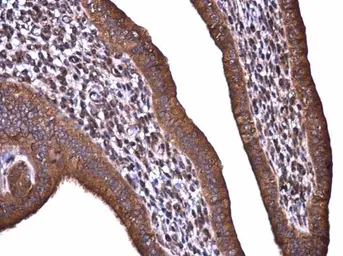 Anti-Acetyl-CoA Carboxylase 1 antibody used in IHC (Paraffin sections) (IHC-P). GTX132081