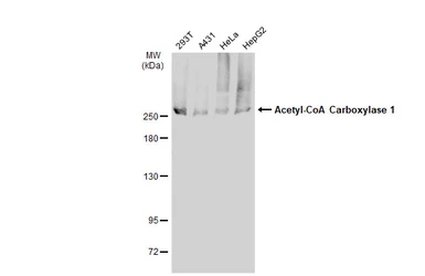 Anti-Acetyl-CoA Carboxylase 1 antibody used in Western Blot (WB). GTX132081