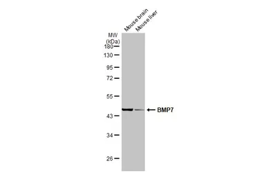 Anti-BMP7 antibody used in Western Blot (WB). GTX132085