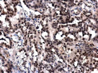 Anti-POLE antibody used in IHC (Paraffin sections) (IHC-P). GTX132100