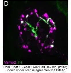 Anti-Vamp2 antibody used in Immunohistochemistry (IHC). GTX132130