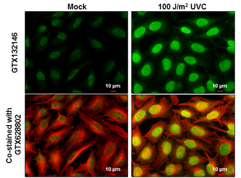 Anti-ATM (phospho Ser1981) antibody used in Immunocytochemistry/ Immunofluorescence (ICC/IF). GTX132146