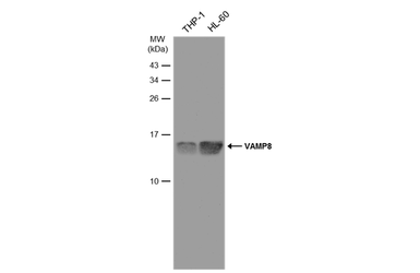 Anti-VAMP8 antibody used in Western Blot (WB). GTX132181