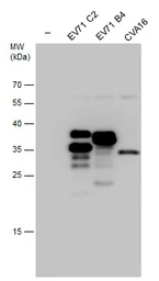 Anti-Enterovirus 71 VP1 antibody used in Western Blot (WB). GTX132338