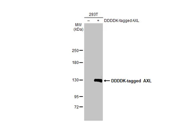 Anti-AXL antibody used in Western Blot (WB). GTX132387