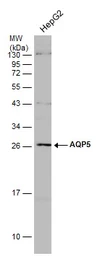 Anti-Aquaporin 5 antibody used in Western Blot (WB). GTX132400