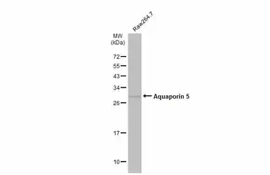Anti-Aquaporin 5 antibody used in Western Blot (WB). GTX132400