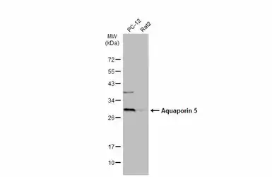 Anti-Aquaporin 5 antibody used in Western Blot (WB). GTX132400