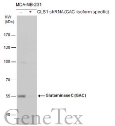 Anti-Glutaminase C (GAC) antibody used in Western Blot (WB). GTX132402