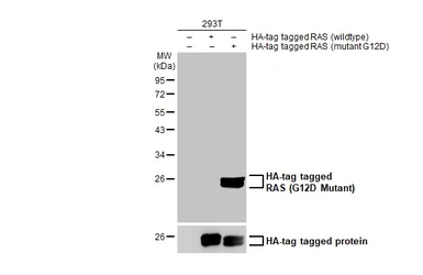 Anti-RAS (G12D Mutant) antibody used in Western Blot (WB). GTX132407