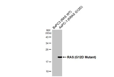 Anti-RAS (G12D Mutant) antibody used in Western Blot (WB). GTX132407